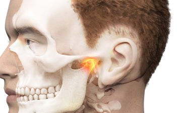 턱관절 약물치료와 보톡스 효과, 치과 구강내과의 접근 | 이선희 원장