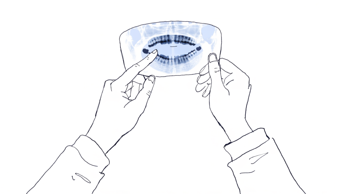파노라마 엑스레이를 들고 서로 다른 치아를 가리키는 두 손 라인아트