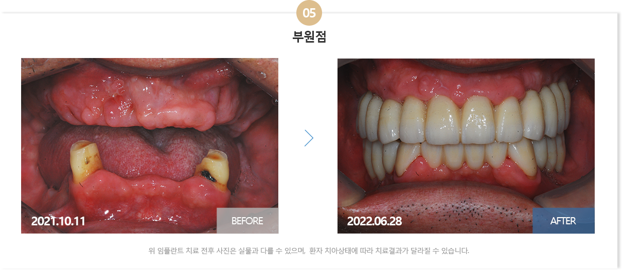 부산뉴욕치과