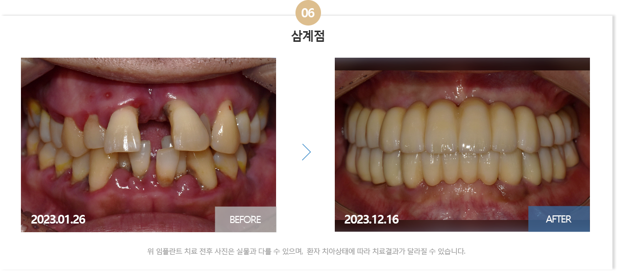 부산뉴욕치과