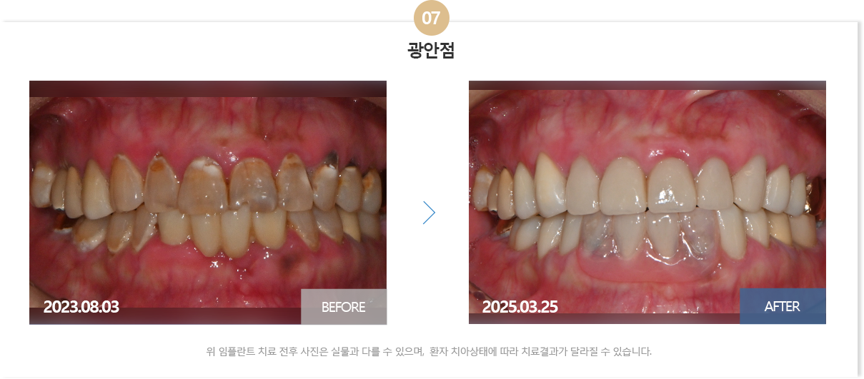 부산뉴욕치과