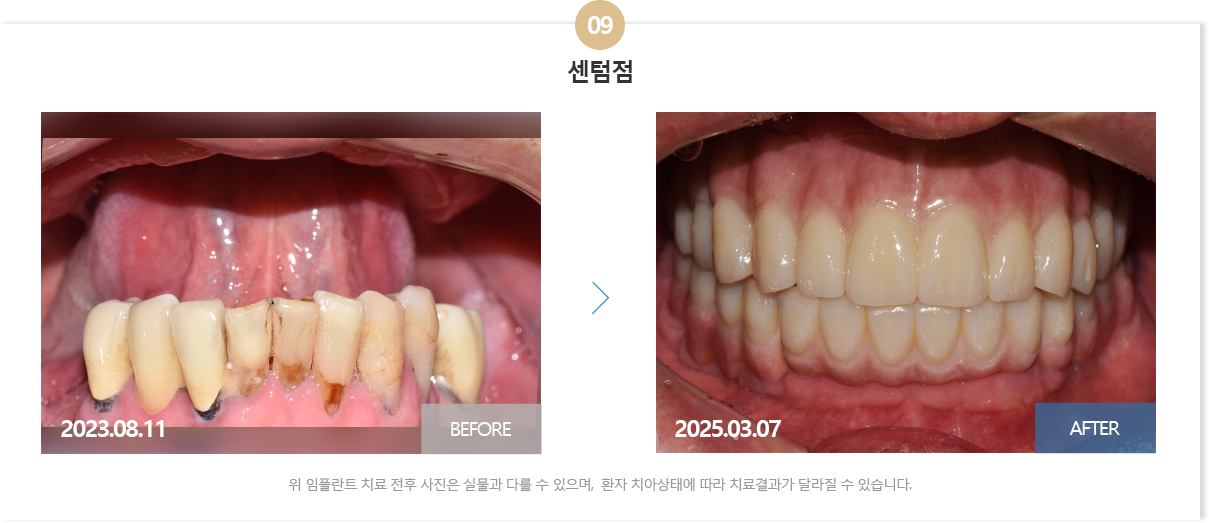부산뉴욕치과