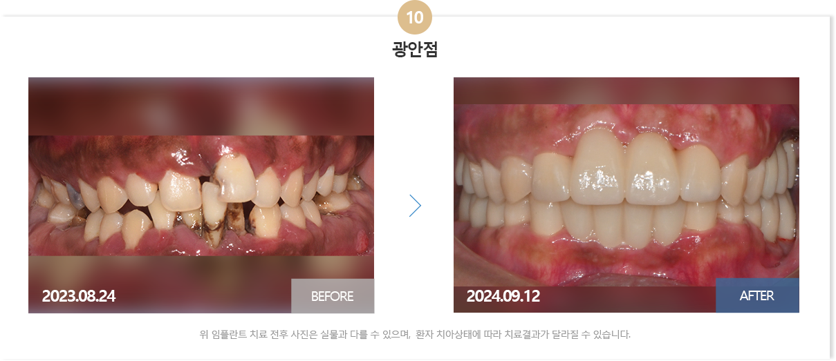 부산뉴욕치과