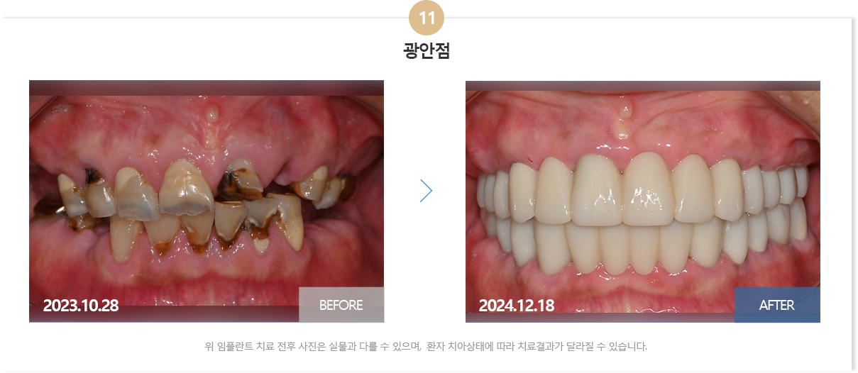 부산뉴욕치과