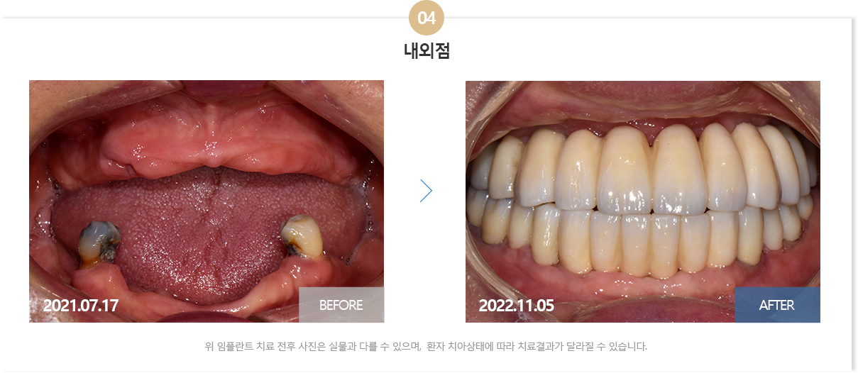부산뉴욕치과