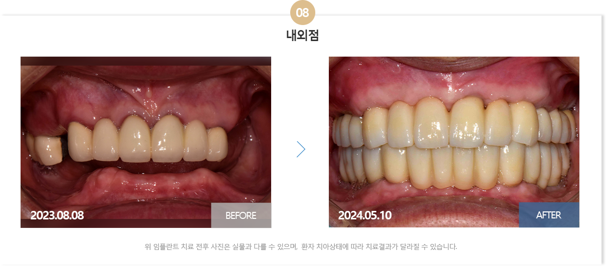 부산뉴욕치과
