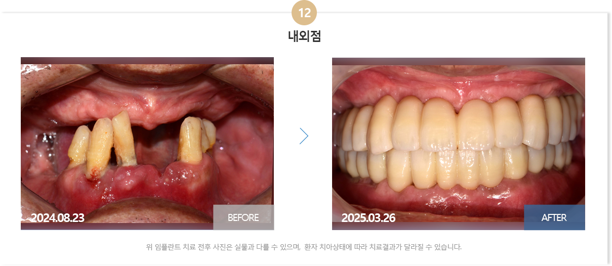 부산뉴욕치과