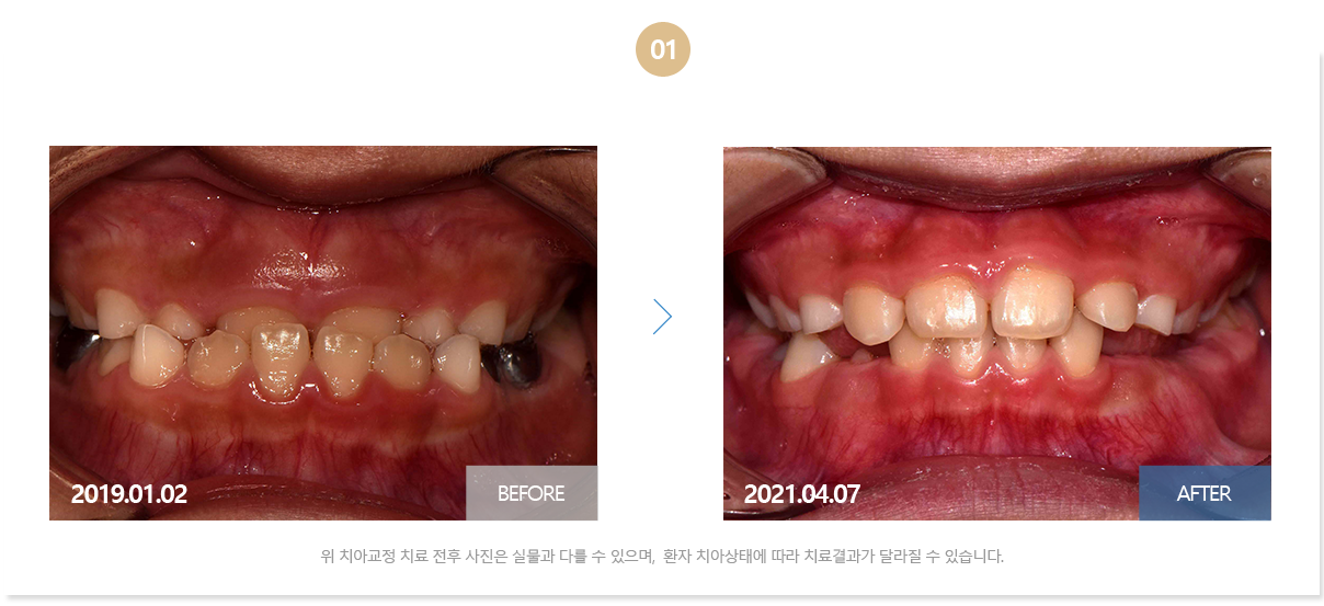 부산뉴욕치과