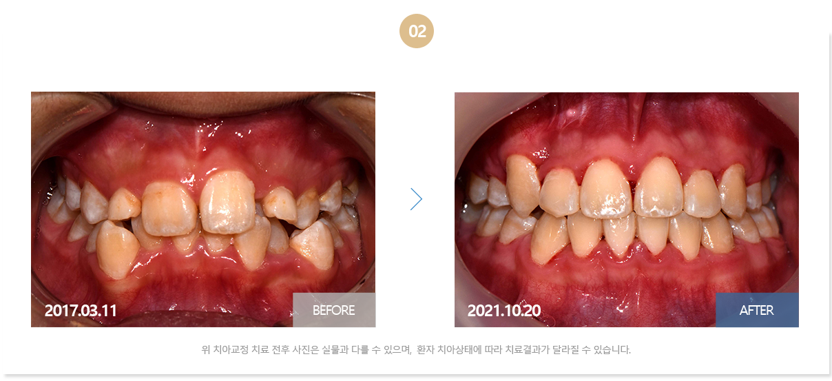 부산뉴욕치과