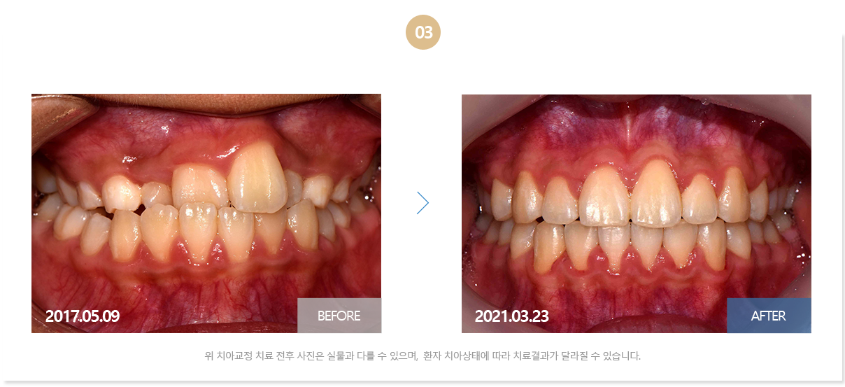 부산뉴욕치과