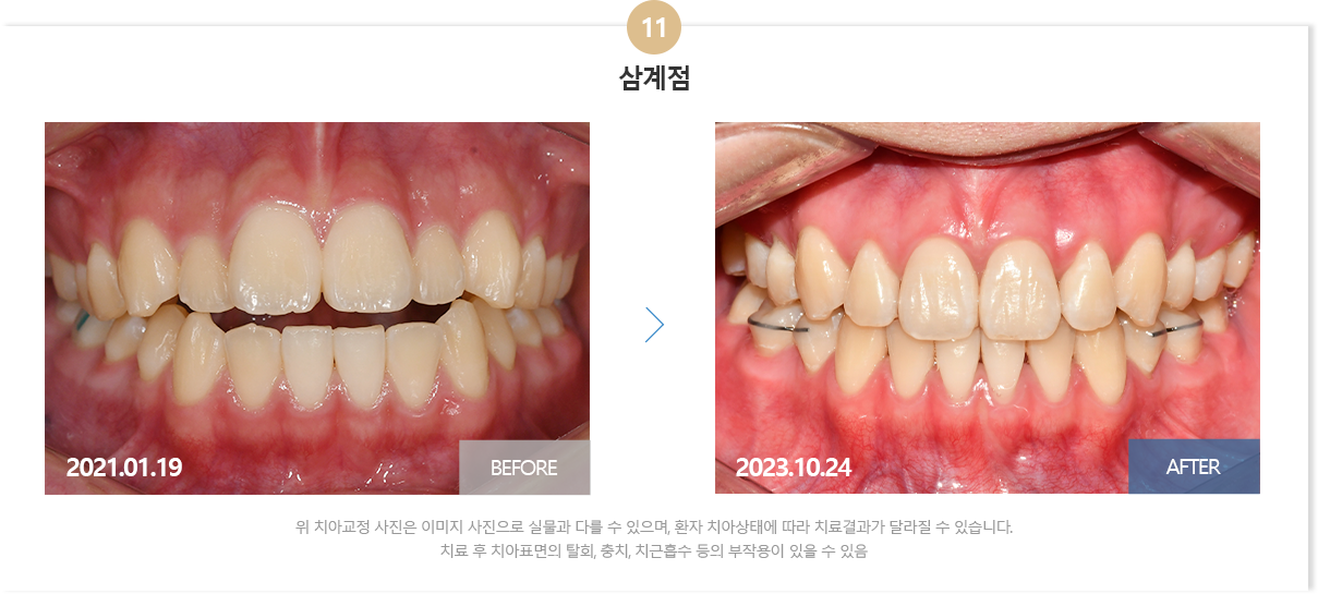 부산뉴욕치과