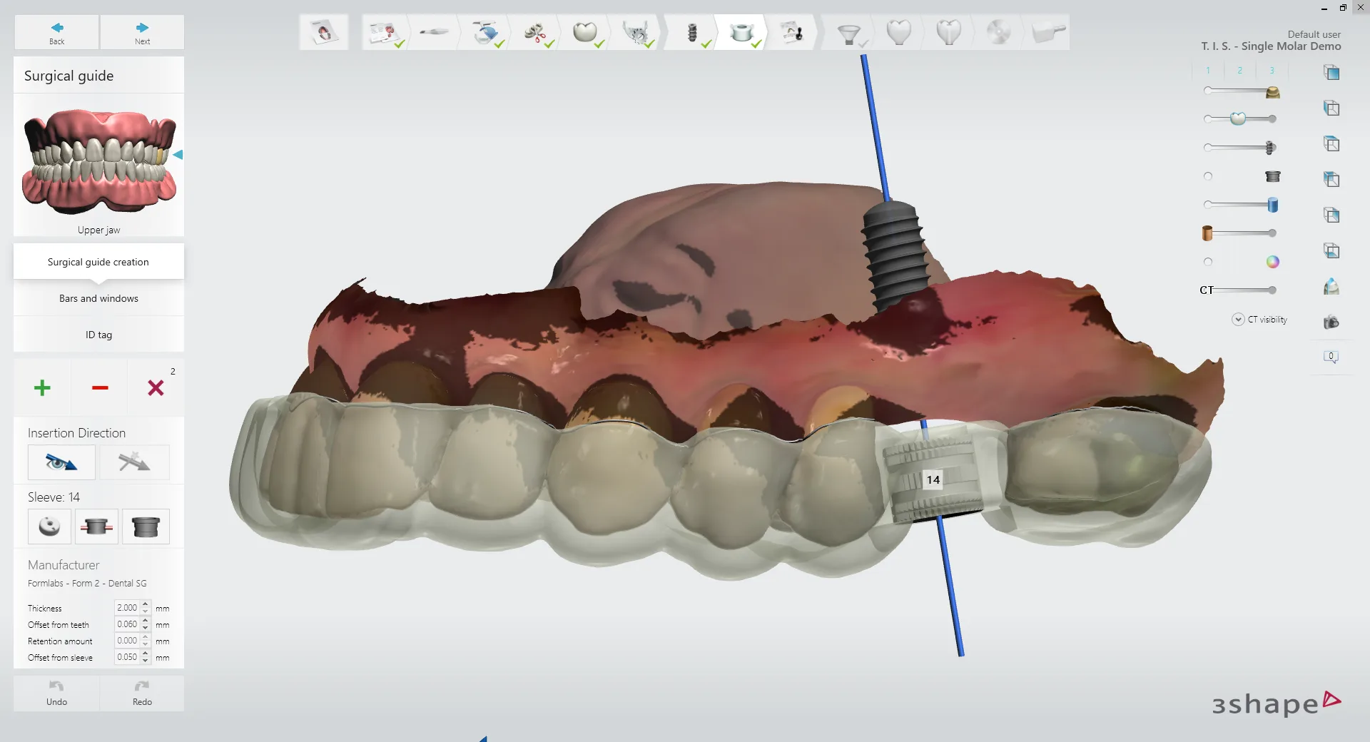 Phần mềm lập kế hoạch 3Shape Implant Studio